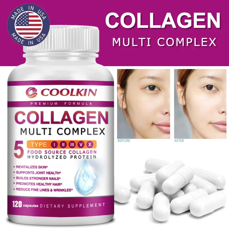 Collagen Multi Complex - Types - Coffee X 评论和价格